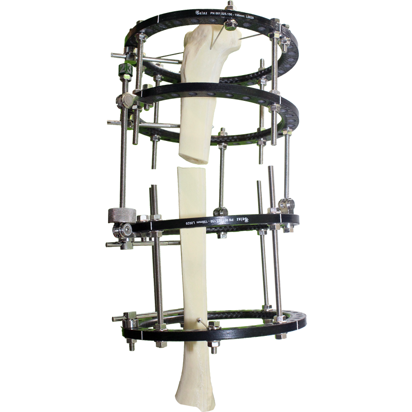 Fixador Circular Radiotransparente